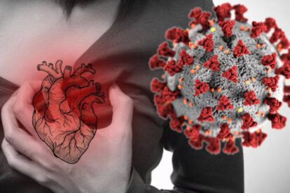 Infecciones virales y riesgo cardiovascular