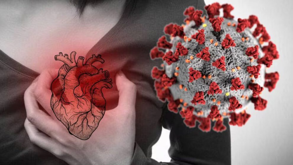 Infecciones virales y riesgo cardiovascular