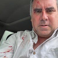 Rafael Belaúnde Llosa sobrevive a atentado a balazos