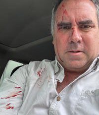 Rafael Belaúnde Llosa sobrevive a atentado a balazos