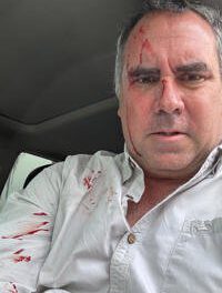 Rafael Belaúnde Llosa sobrevive a atentado a balazos