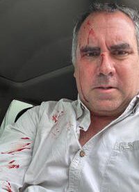 Rafael Belaúnde Llosa sobrevive a atentado a balazos