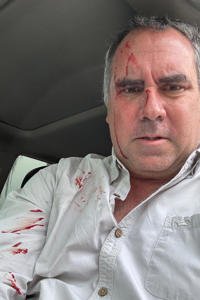 Rafael Belaúnde Llosa sobrevive a atentado a balazos