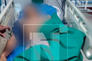 Hombre muere tras balacera en el trópico de Cochabamba