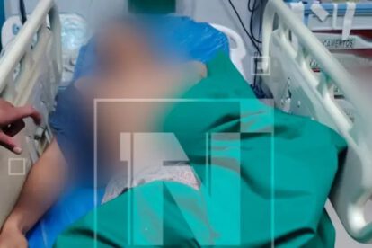 Hombre muere tras balacera en el trópico de Cochabamba