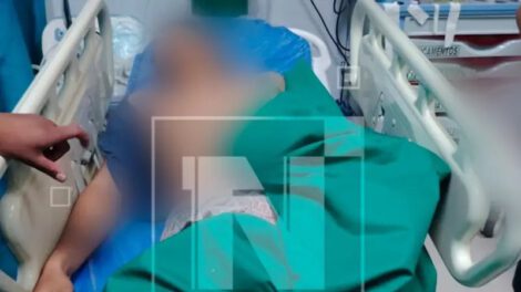 Hombre muere tras balacera en el trópico de Cochabamba