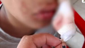 Le dan veinte días de impedimento, a niño de once años, tras sufrir de una golpiza.