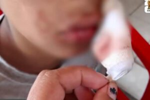 Le dan veinte días de impedimento, a niño de once años, tras sufrir de una golpiza.