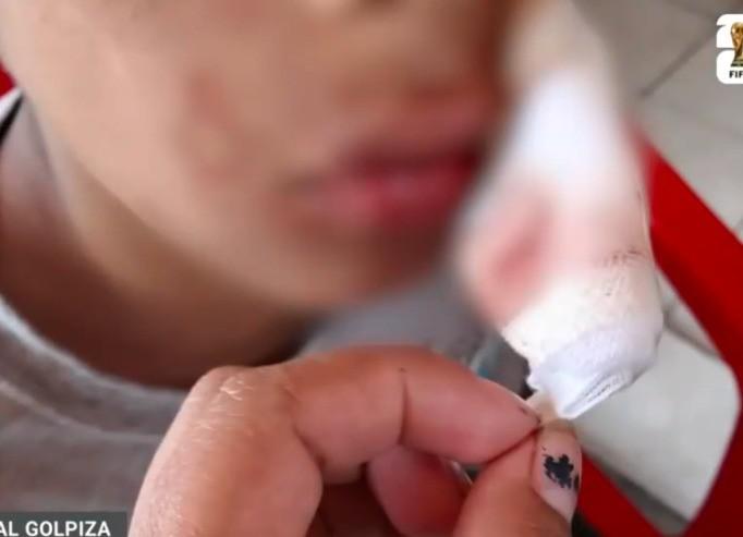 Le dan veinte días de impedimento, a niño de once años, tras sufrir de una golpiza.