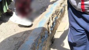 El comerciante a cargo del puesto sufrió la amputación traumática de uno de sus dedos