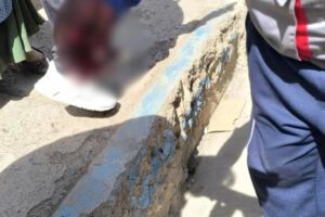 El comerciante a cargo del puesto sufrió la amputación traumática de uno de sus dedos