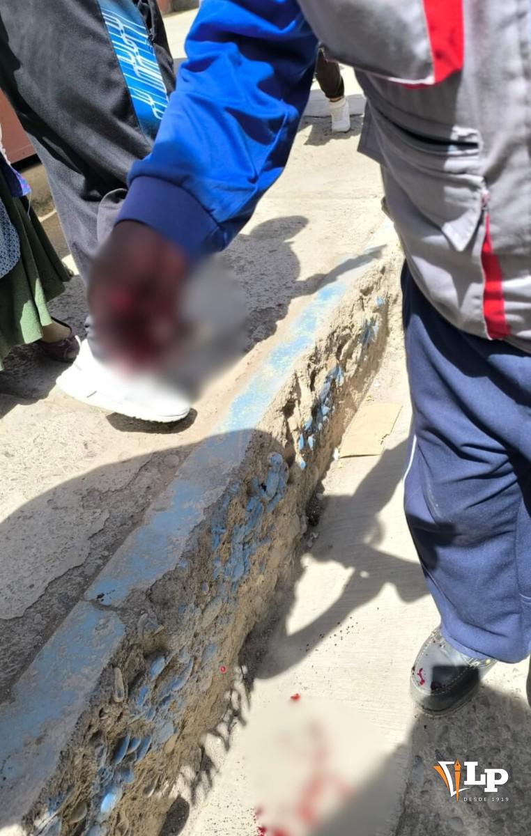 El comerciante a cargo del puesto sufrió la amputación traumática de uno de sus dedos