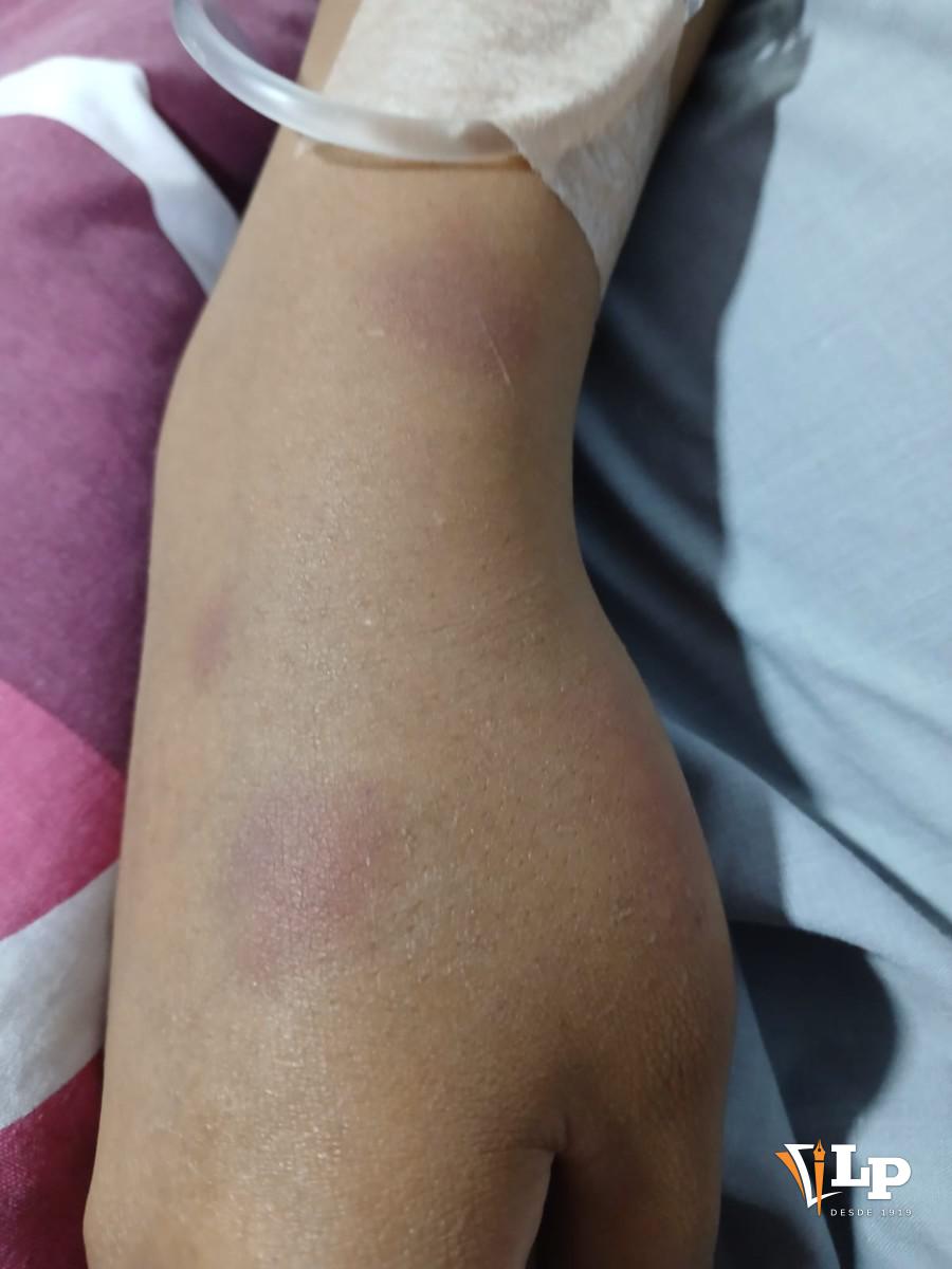 Agresión a pareja en Oruro