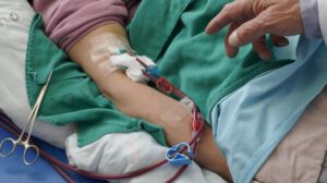 Paciente en hemodíalisis