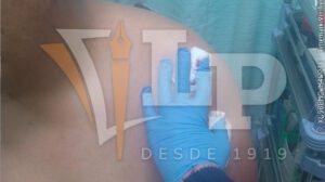 Imagen del profesor siendo atendido