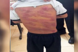 Padre flageló a su hijo con síndrome de Down
