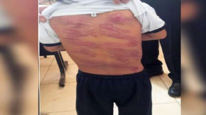 Padre flageló a su hijo con síndrome de Down
