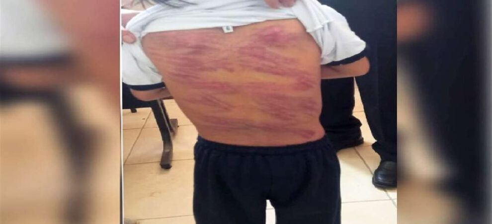 Padre flageló a su hijo con síndrome de Down