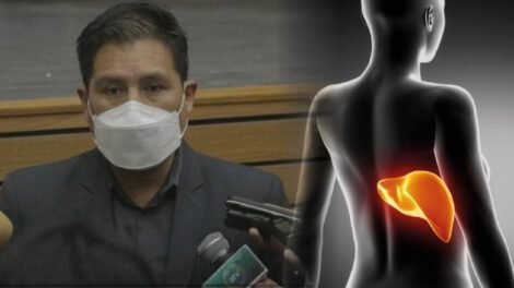 Gobierno mantiene vigilancia epidemiológica para evitar posible brote de hepatitis inusual en Bolivia