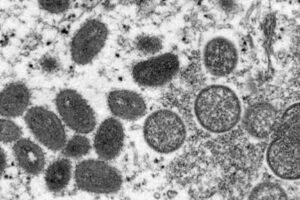 OMS informa de 131 casos de viruela del mono