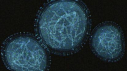 Imagen de referencia sobre el virus símico