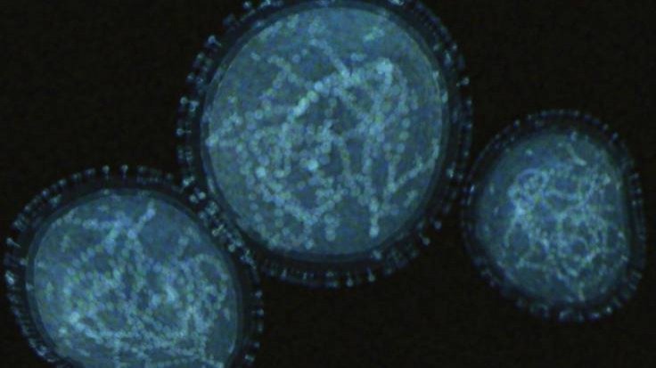 Imagen de referencia sobre el virus símico