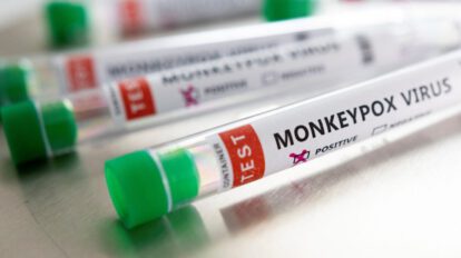 La OMS confirma más de 5.000 casos de viruela del mono en el mundo