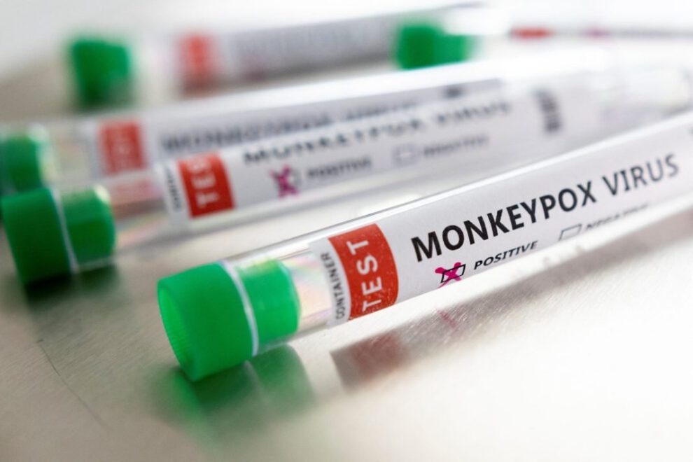 La OMS confirma más de 5.000 casos de viruela del mono en el mundo