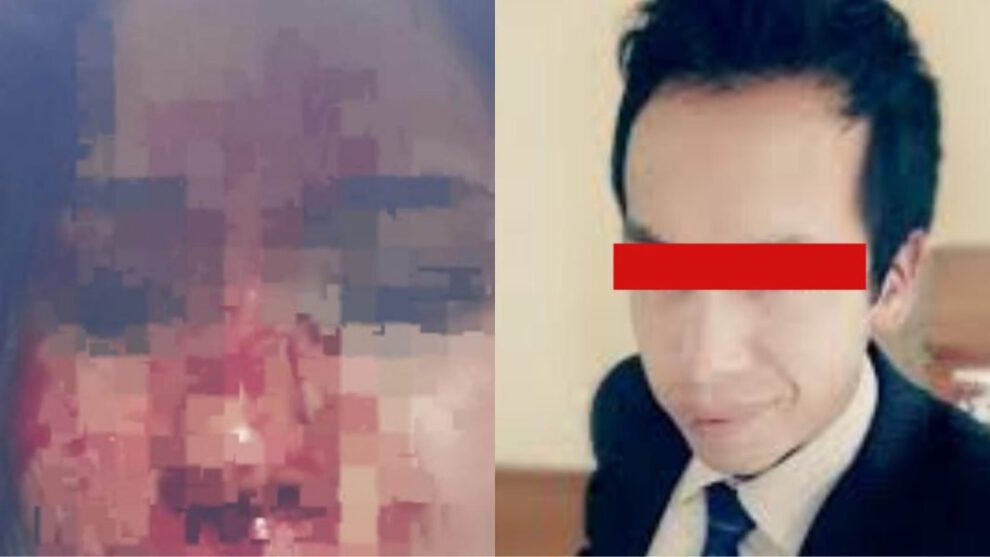 Periodista acusado de violencia familiar