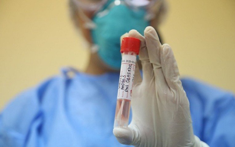 Uso obligatorio del barbijo en Perú por incremento de casos de Covid-19