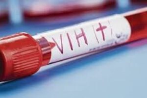 Incrementan los casos de VIH-SIDA en Oruro