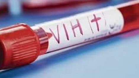 Incrementan los casos de VIH-SIDA en Oruro