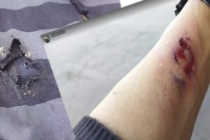 Nicolás Sanabria herido en enfrentamientos callejeros