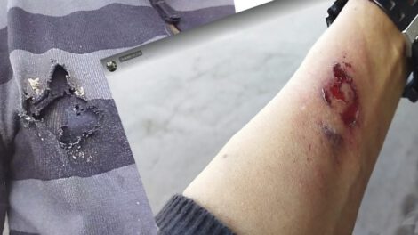 Nicolás Sanabria herido en enfrentamientos callejeros
