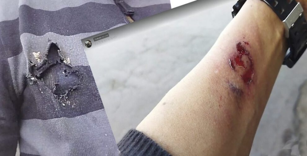 Nicolás Sanabria herido en enfrentamientos callejeros