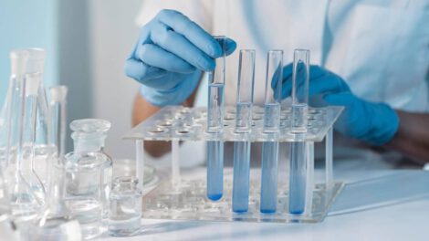 Seguimiento de casos de viruela del mono en el país