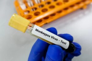 Muestra del virus de la viruela del mono en Bolivia
