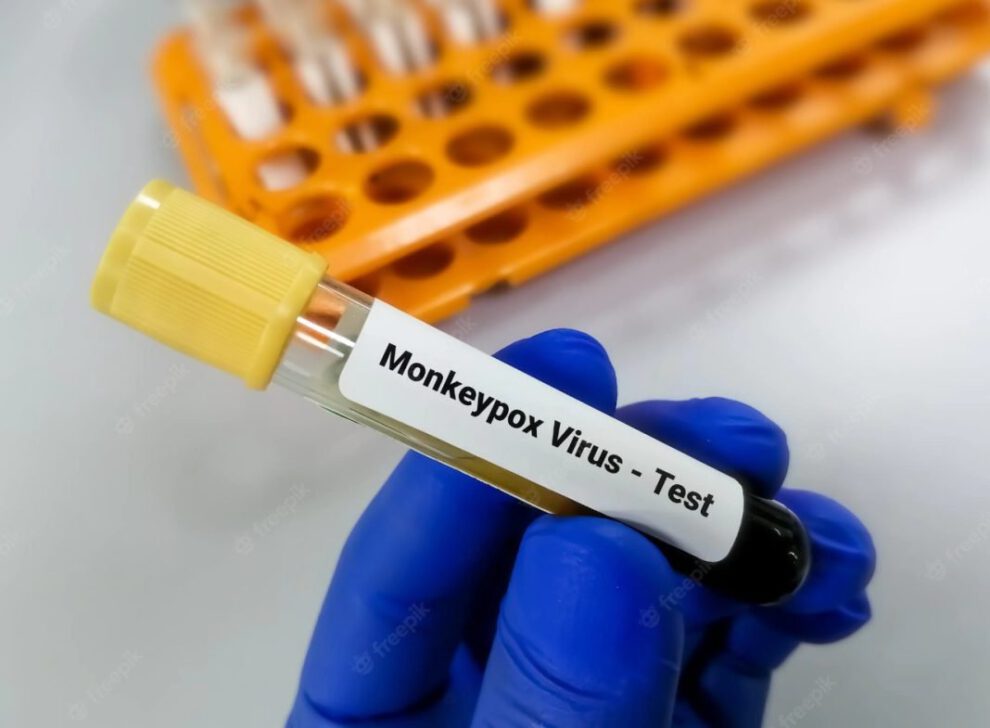 Muestra del virus de la viruela del mono en Bolivia