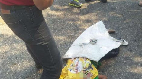 Niño atropellado en Santa Cruz mientras limpiaba vidrios