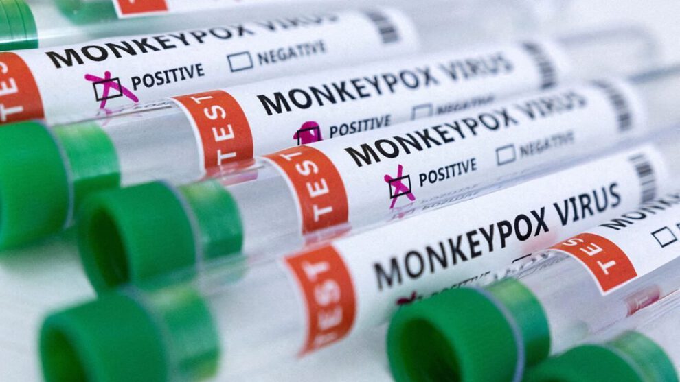 Muestras positivas de viruela del mono