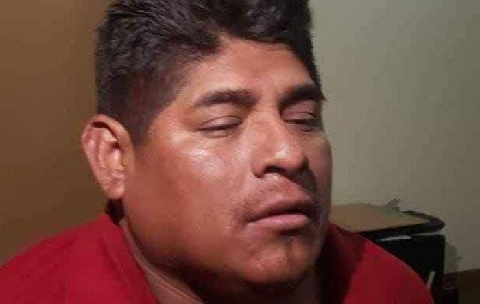 César Apaza, presidente del Comité de Autodefensa de Adepcoca