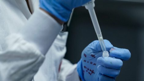 Mujer muere de lepra en un hospital