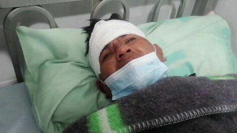 Periodista agredido, Mario Rocabado