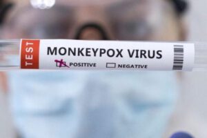 Mpox, nuevo nombre de la viruela del mono