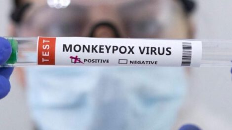 Mpox, nuevo nombre de la viruela del mono