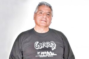 Dante Uzquiano requiere una prótesis con urgencia