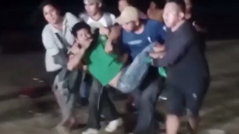 Herido de bala siendo llevado a un centro médico en Mapiri