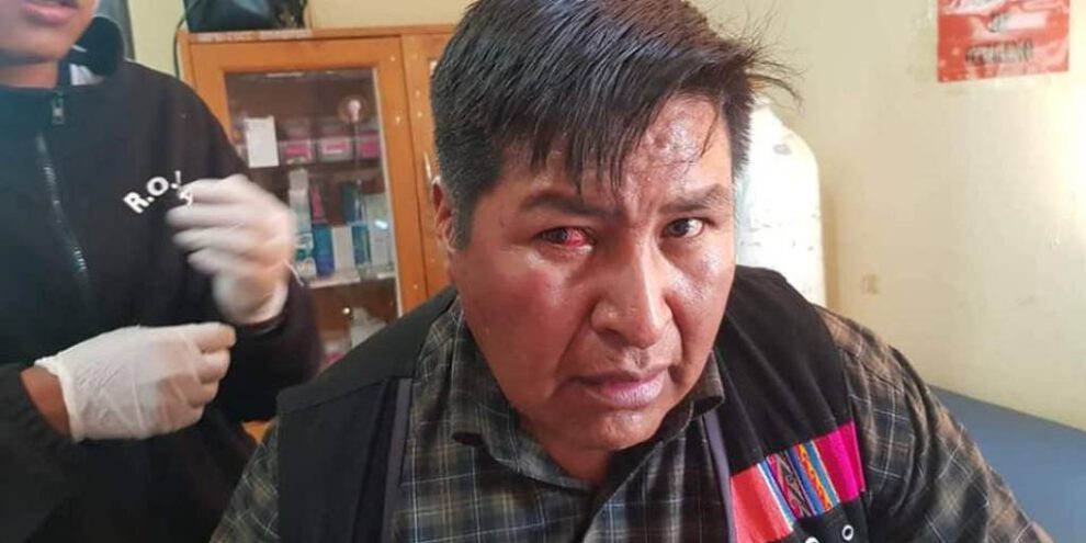 Evo Morales abandonó a su pueblo según Martín Choque