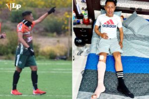 Harold Calle en proceso de recuperación tras fractura