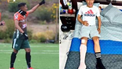 Harold Calle en proceso de recuperación tras fractura